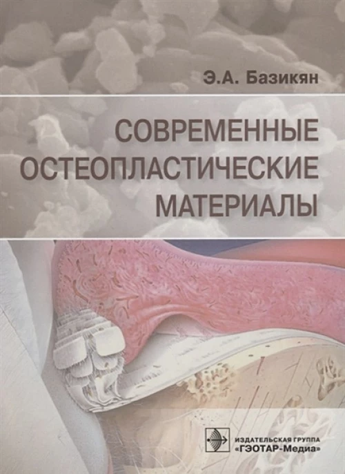 Современные остеопластические материалы