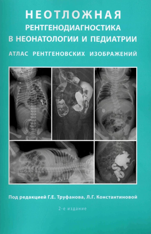 Неотложная рентгенодиагностика в неонатологии и педиатрии (Атлас рентгеновских изображений): Учебное пособие. 2-е изд., доп и перераб