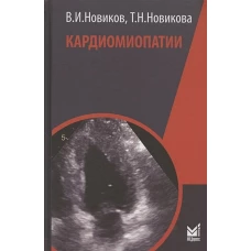 Кардиомиопатии