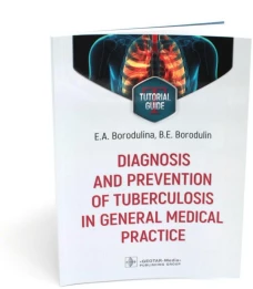 Diagnosis and prevention of tuberculosis in general medical practice: tutorial guide = Диагностика и профилактика туберкулеза в общей врачебной практи
