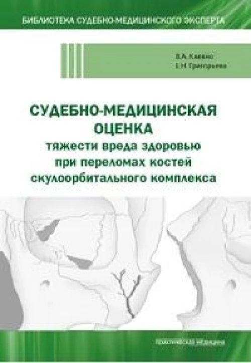 Судебно-медицинская оценка тяжести вреда здоровью при переломах костей скулоорбитального комплекса: монография