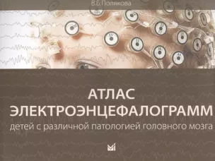 Атлас электроэнцефалограмм детей с различной патологией головного мозга